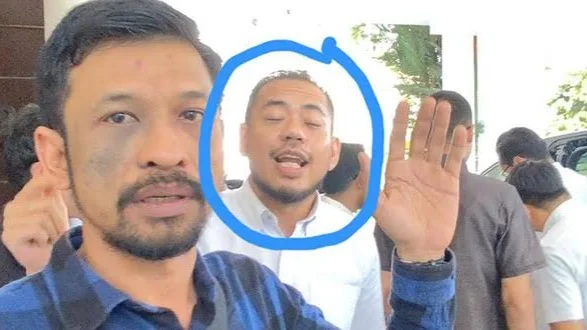 Diduga Pemain Dana Kelurahan di Pemko Medan, KPK Harus Periksa Rio Adrian Sukma!
